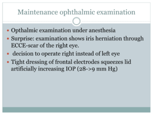 slide12